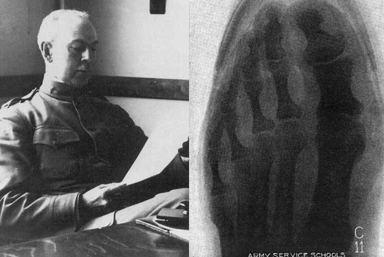 Dr. Edward Munson and an x-ray of the foot inside his lasted boots. Images courtesy: Red Wing Berlin